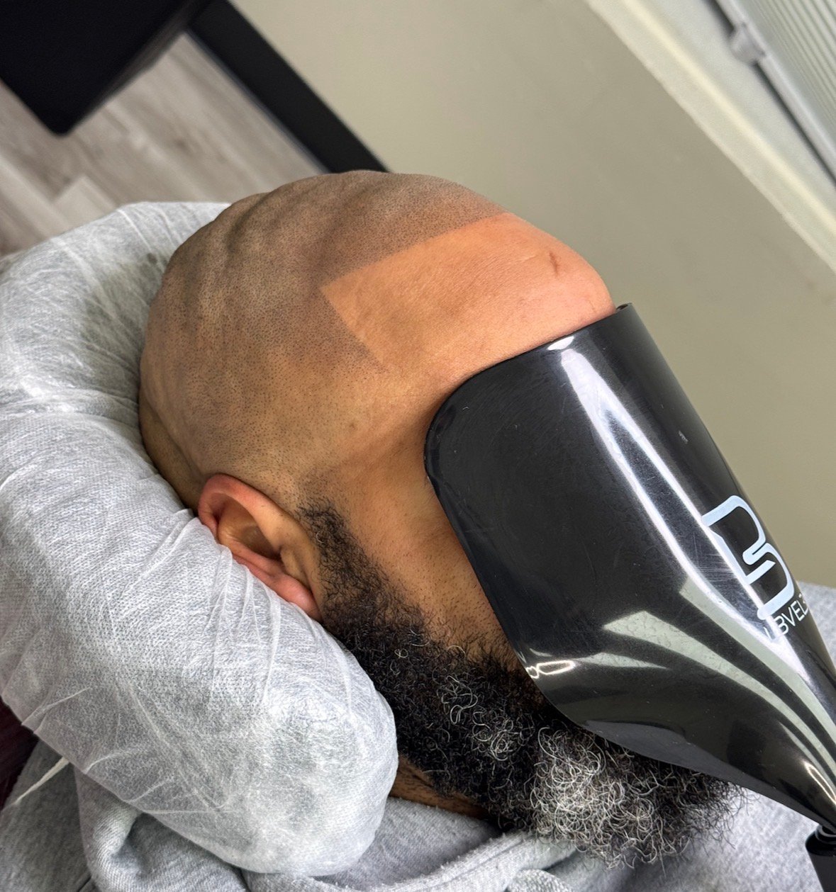 Client 1 after side angle