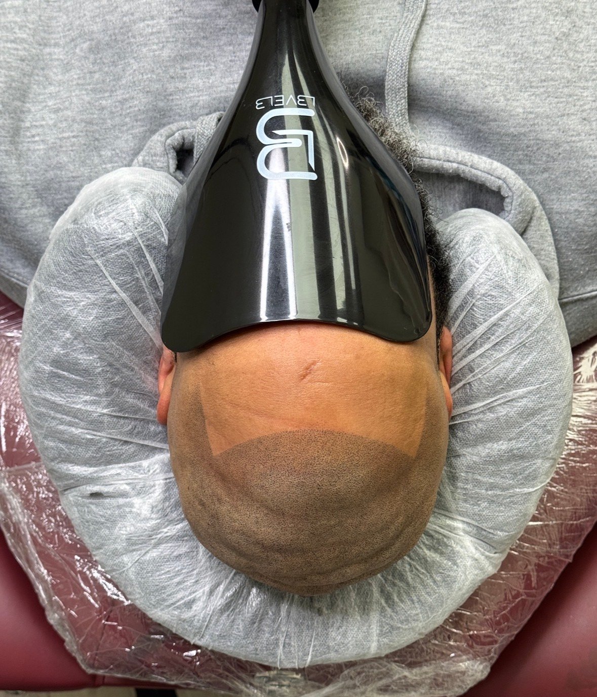 Client 1 after top angle