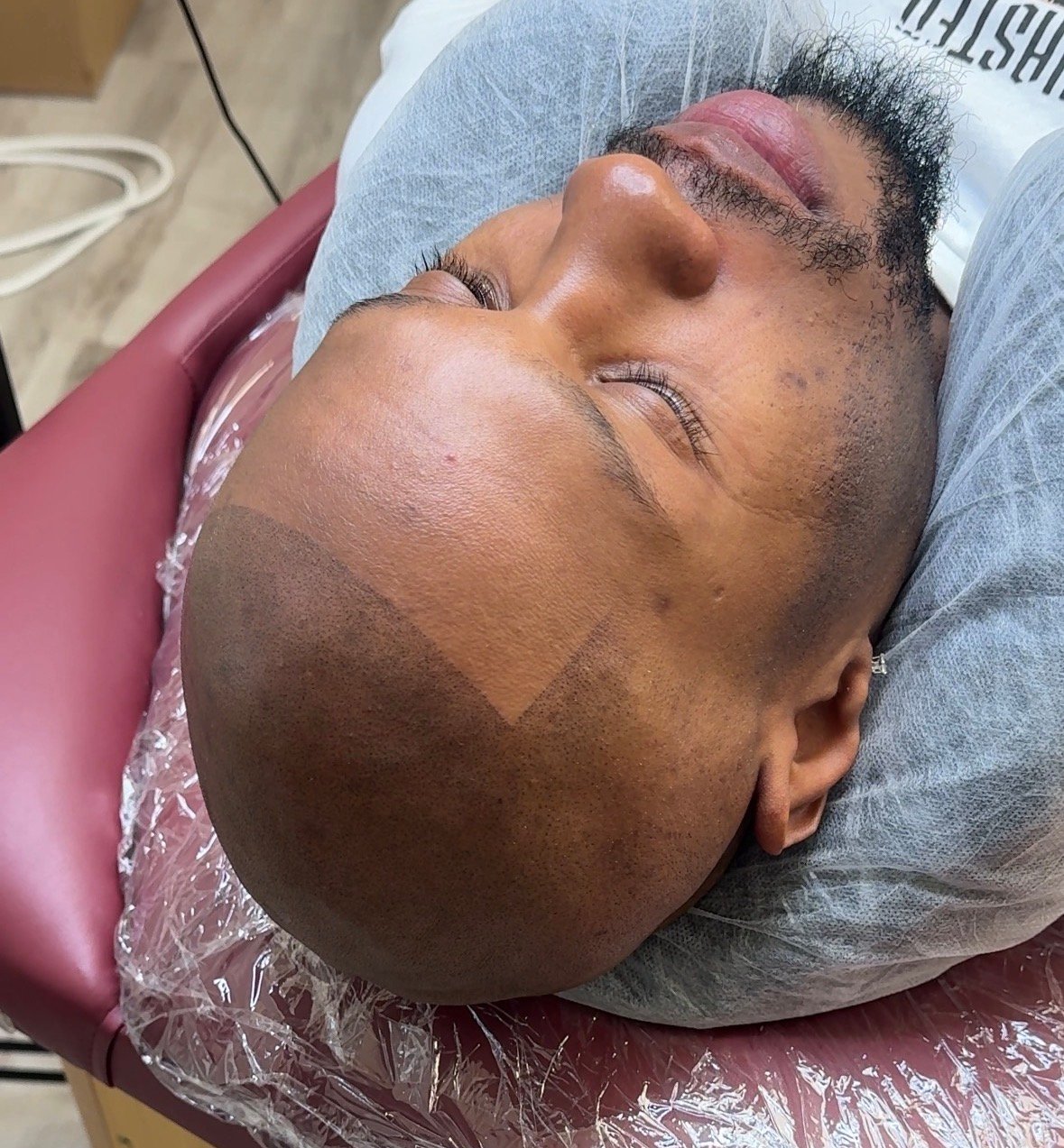 Client 2 after side angle