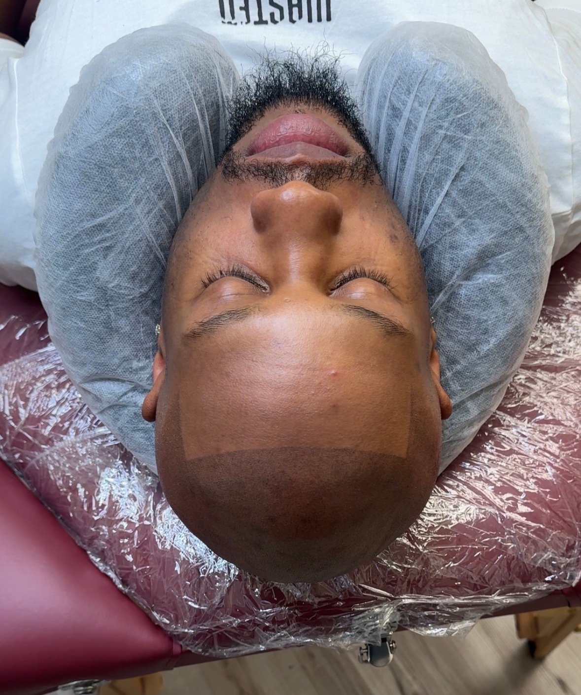 Client 2 after top angle