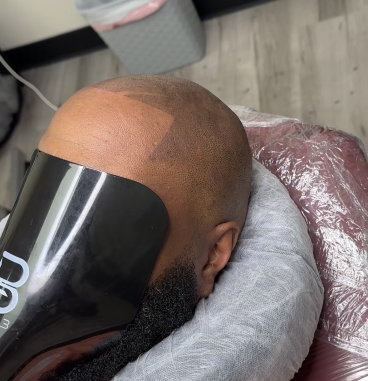 Client 3 after side angle