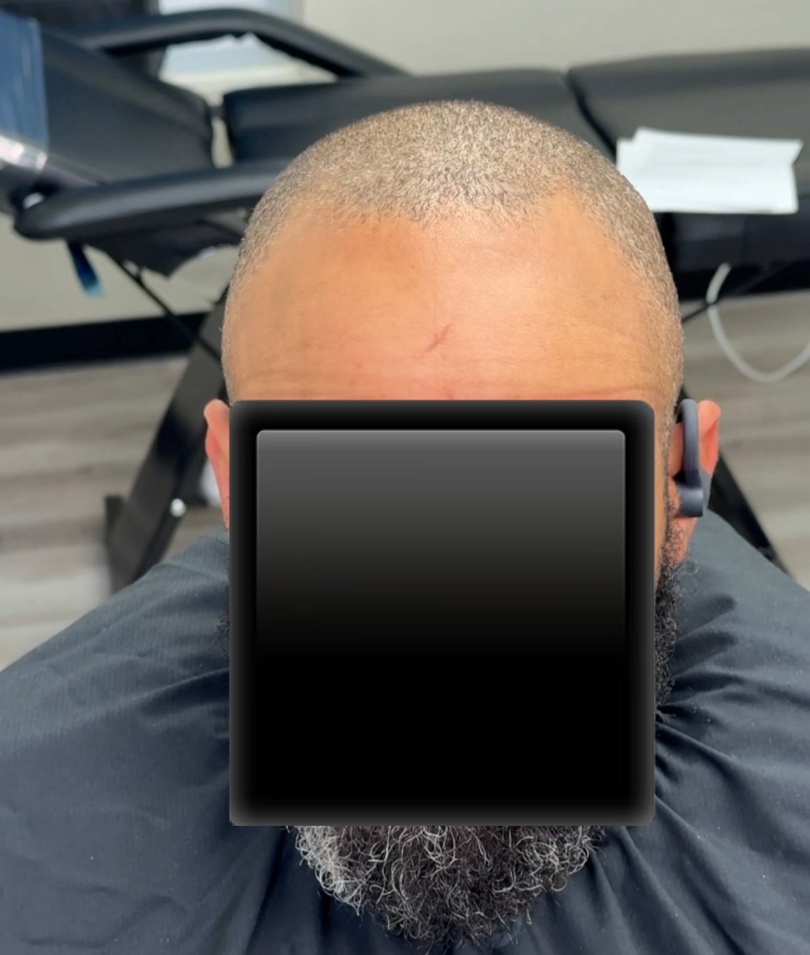Client 1 before
