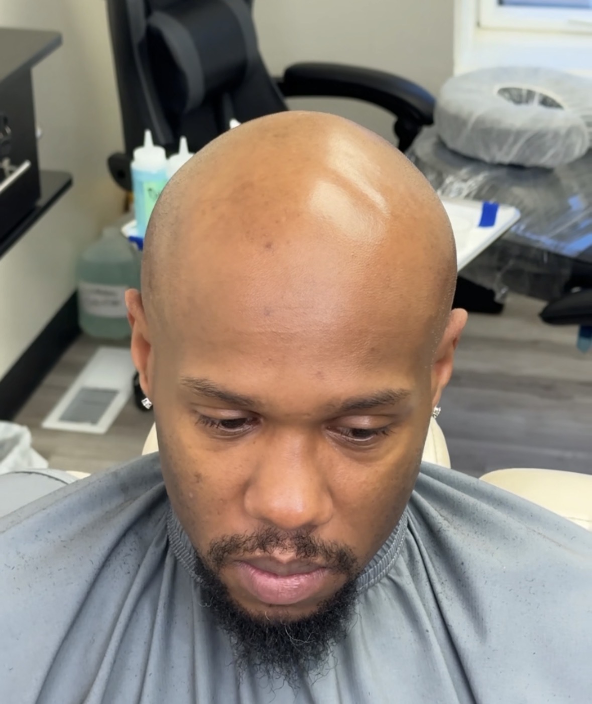 Client 2 before
