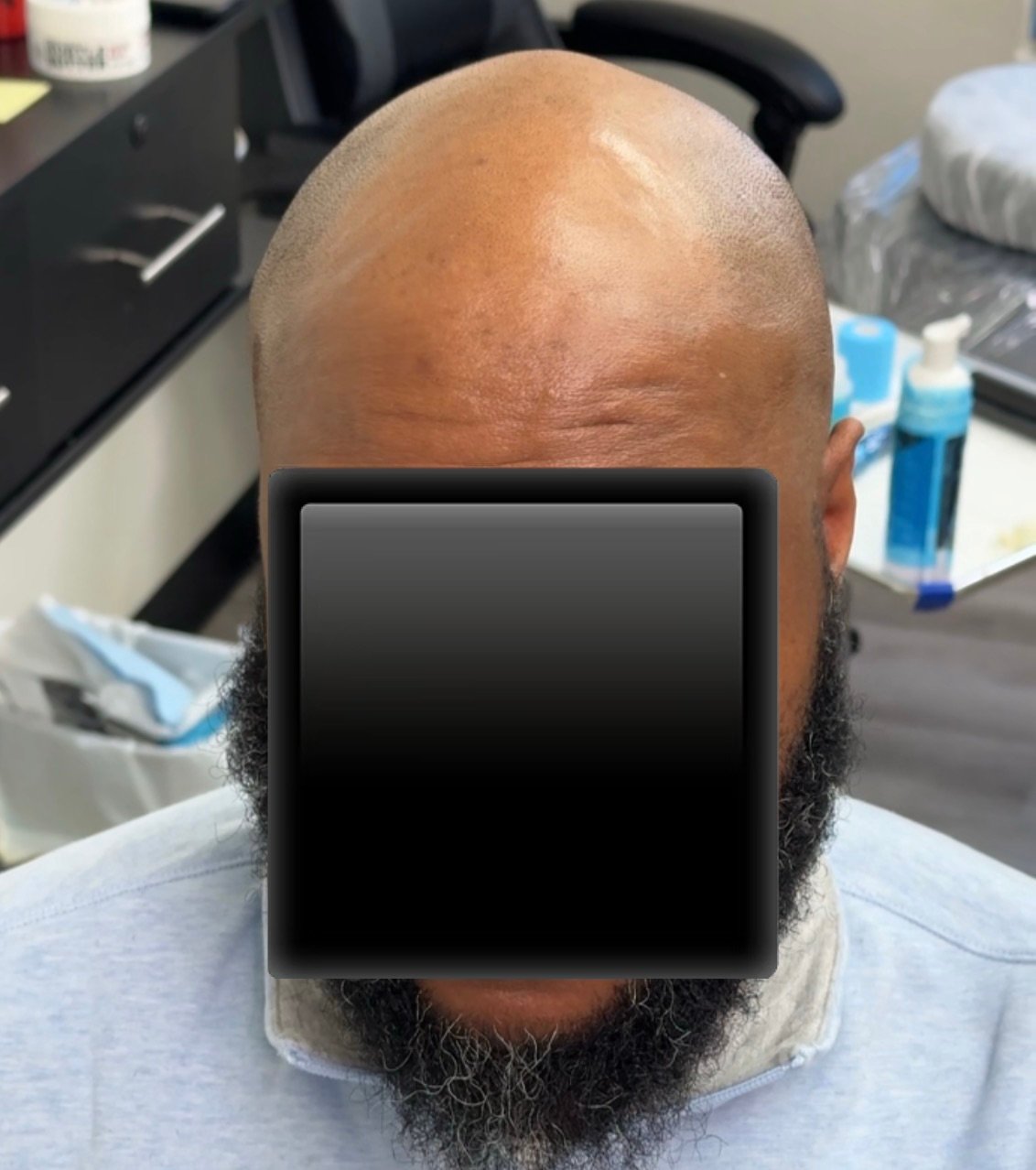 Client 3 before